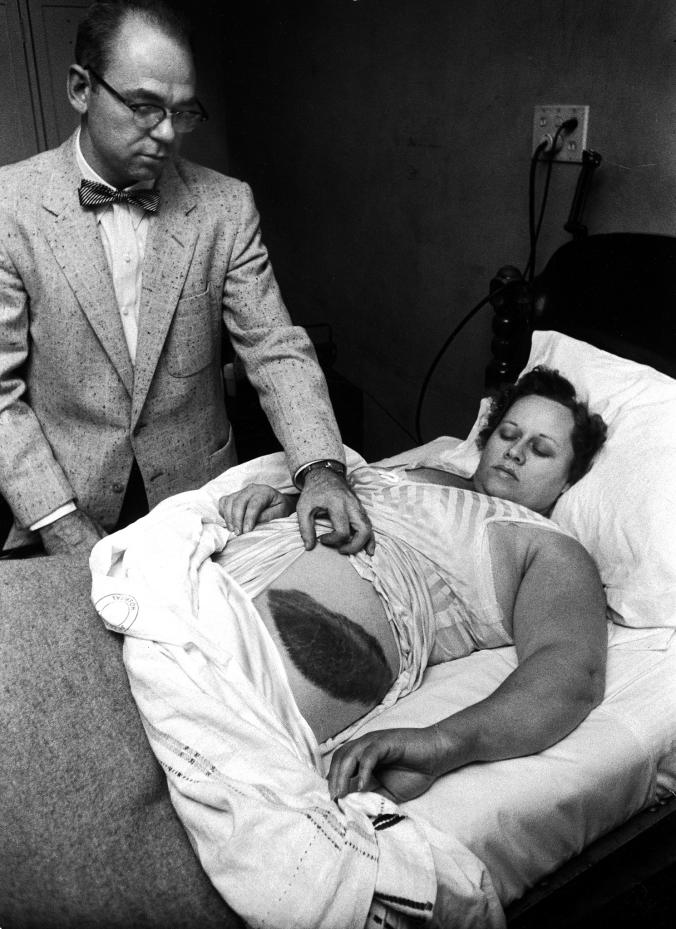 Ann Hodges 30. novembra 1954 med zdravniškim pregledom. Zaradi udarca meteorita je imela na boku veliko modrico. Foto: Getty | Foto: 