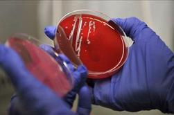 Na Češkem potrdili prvi primer okužbe z bakterijo Ehec