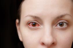 Kaj je vzrok za resne težave z očmi?