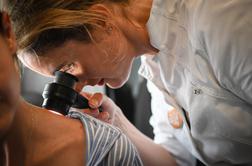 #SAVEYOURSKIN: Brezplačni dermatološki pregledi kožnih znamenj