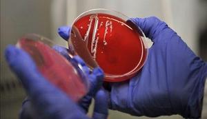 Na Češkem potrdili prvi primer okužbe z bakterijo Ehec