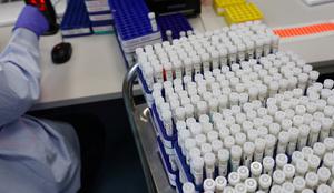Dobra novica o okužbah v Sloveniji, a delež pozitivnih testov ostaja visok #video