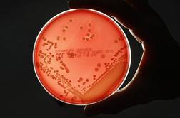 WHO opozarja na vse večjo odpornost bakterij